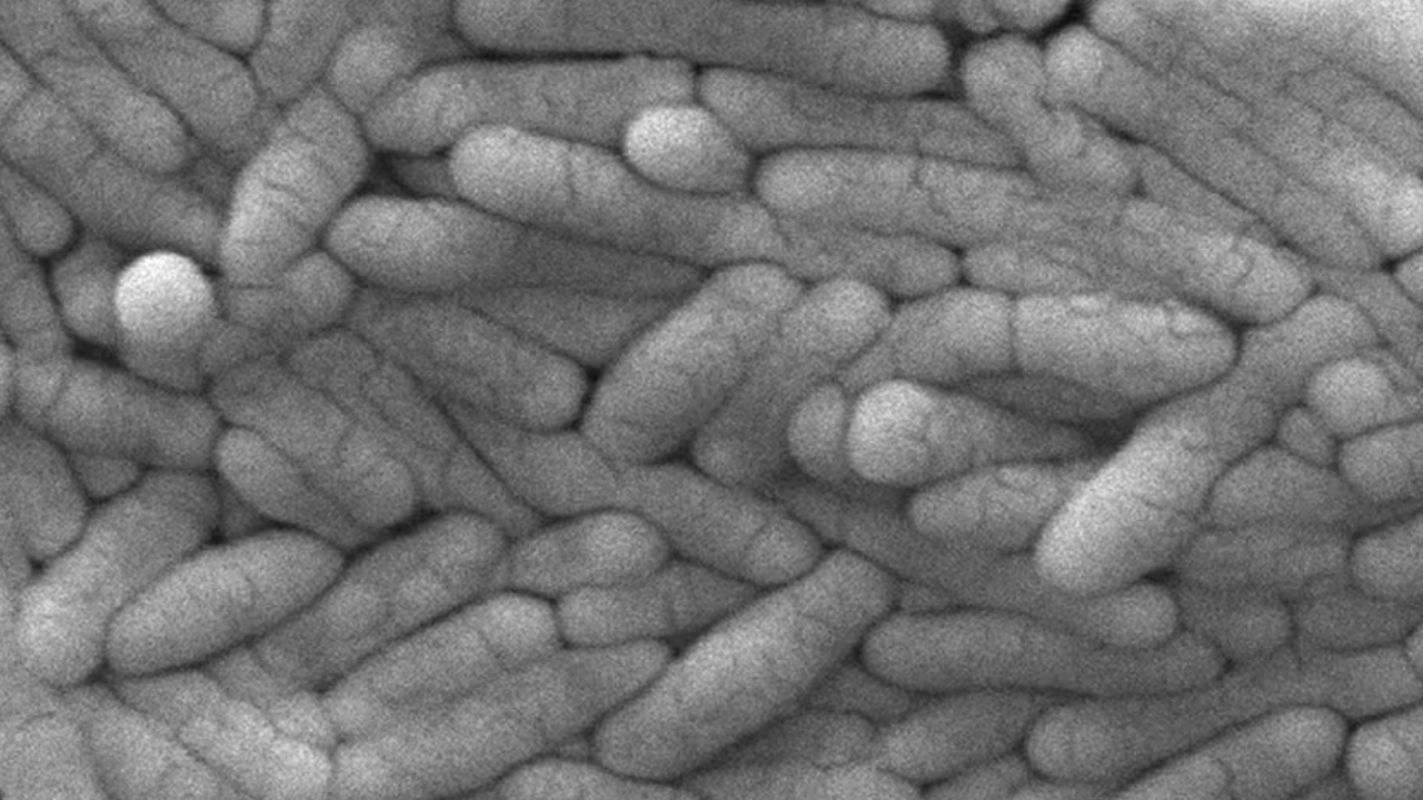 Ciudadela: alerta en los dos edificios donde ya suman 15 los casos de fiebre tifoidea