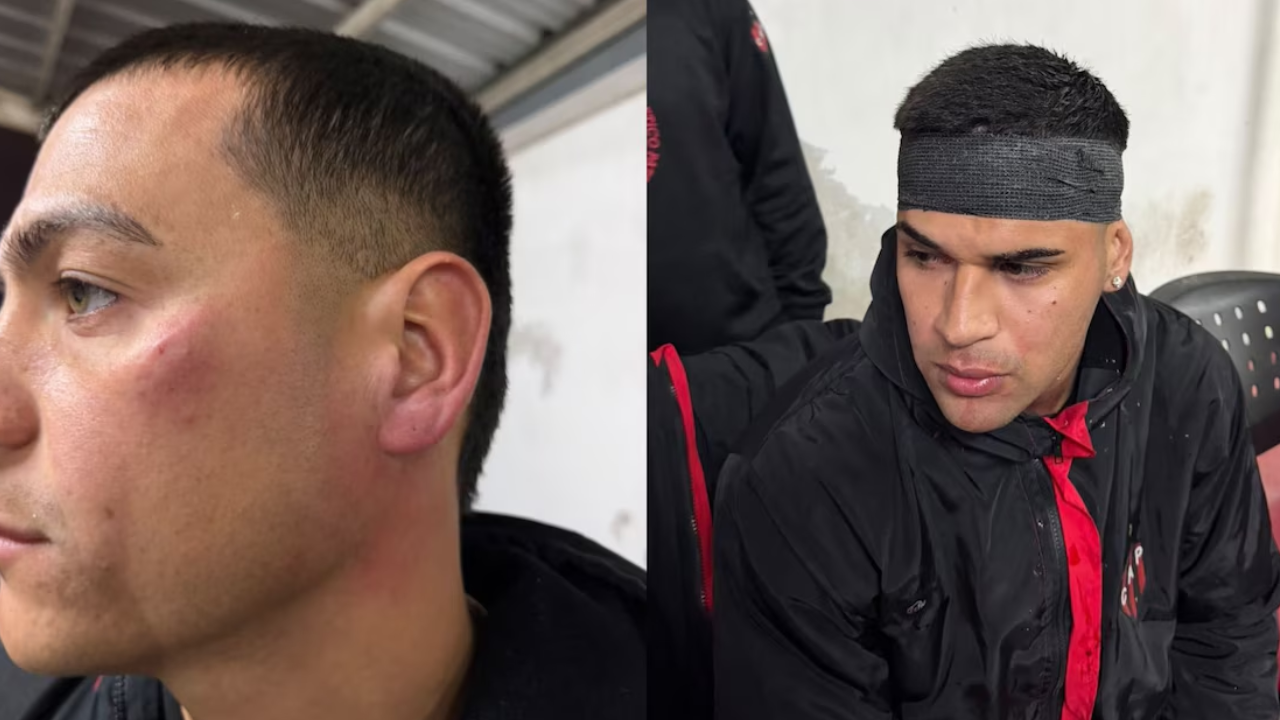 Barrabravas de Patronato agredieron a sus propios jugadores tras la derrota ante Colón